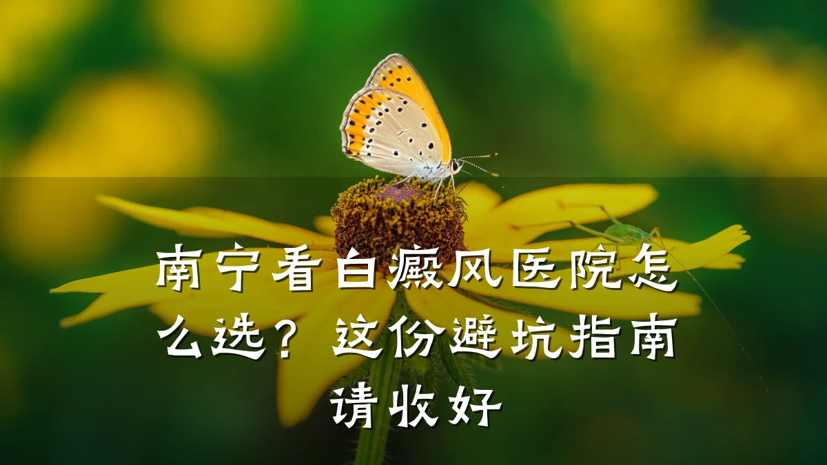 南宁看白癜风医院怎么选?这份避坑指南请收好